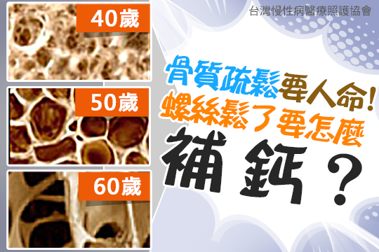 骨質疏鬆要人命，螺絲鬆了要怎麼補鈣？ 